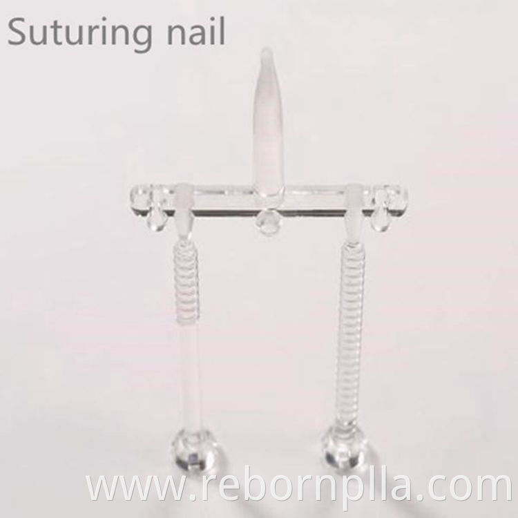 Bone nail